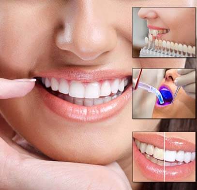 Best cosmetic dentist in aurangabad